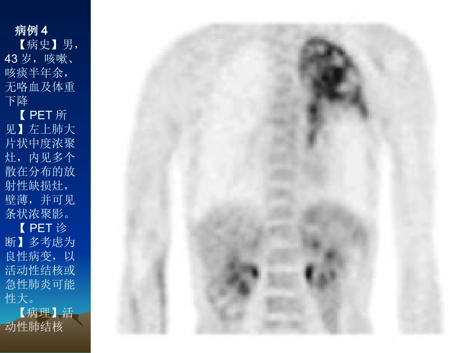 最新PET病例-PPT文档_第3页