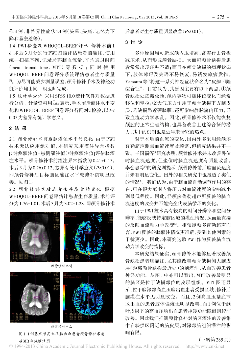 早期颅骨修补术对颅骨缺损患者脑灌注及生存质量的影响_宋健_第2页