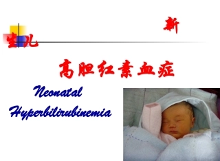新生儿高胆红素血症剖析