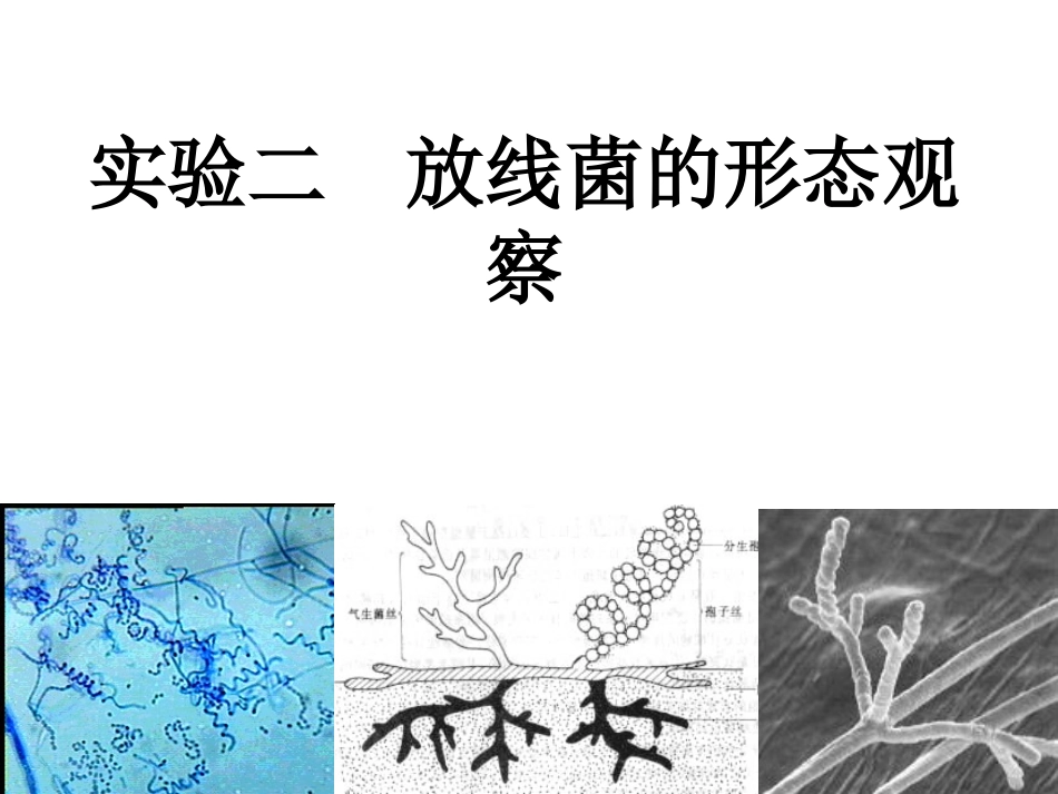放线菌形态观察_第2页