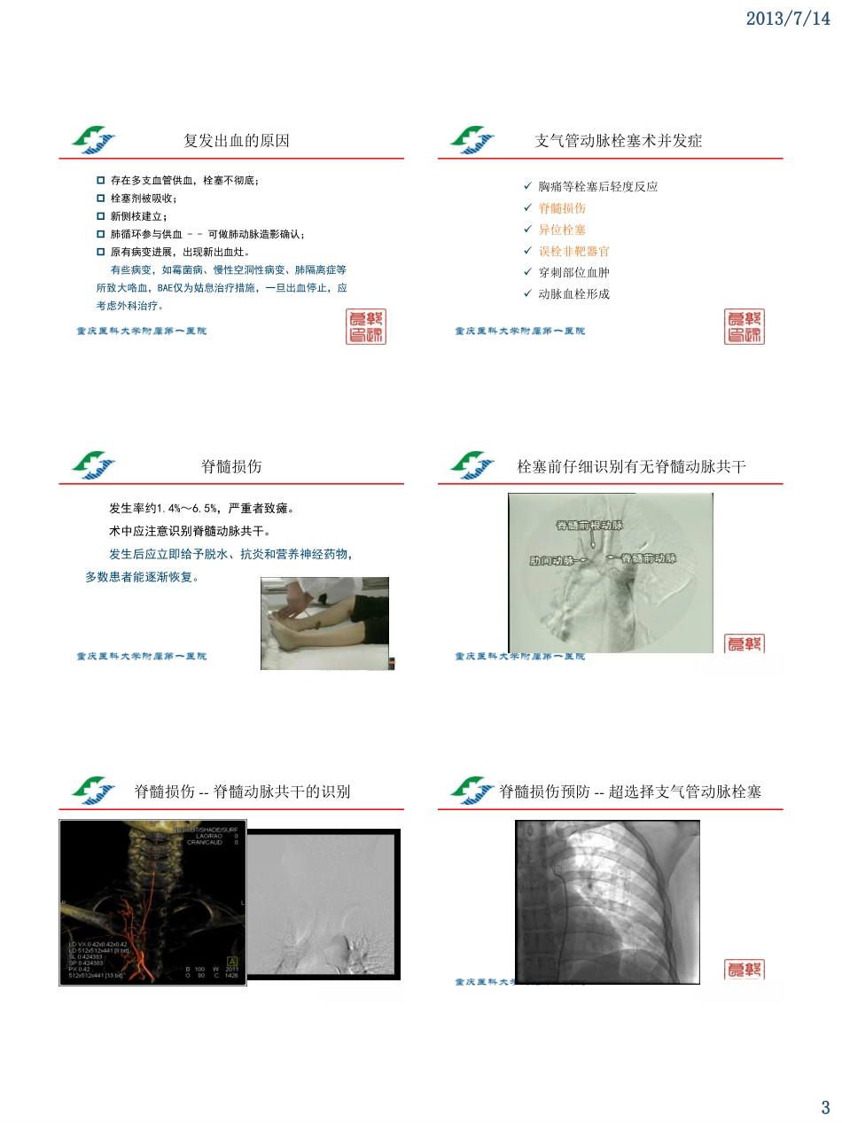支气管动脉栓塞术治疗大咯血技术进展-(十三)_第3页