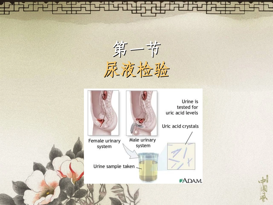 排泄物、分泌物及体液检验.ppt_第2页