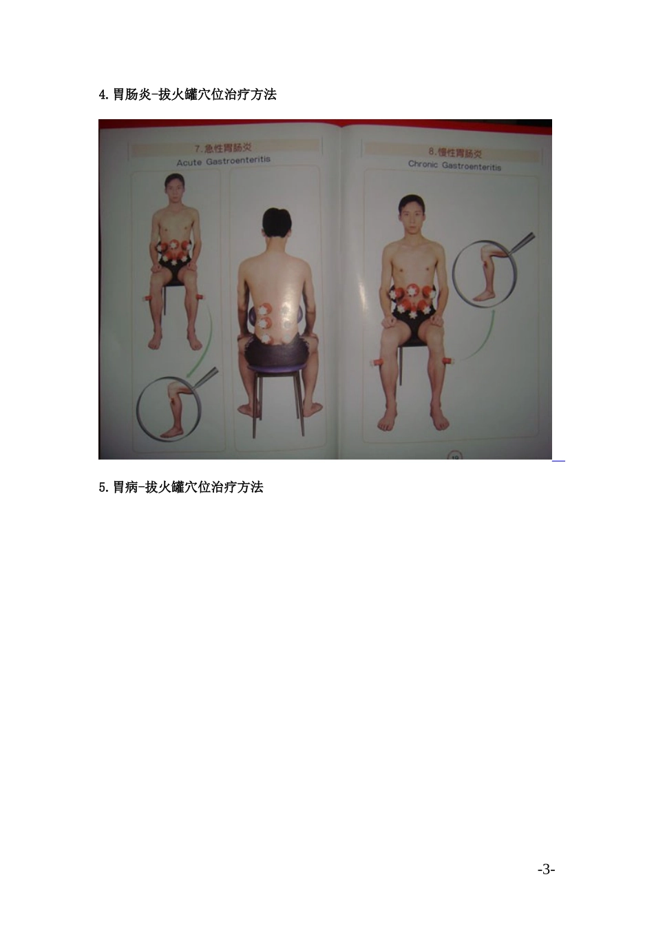 拔火罐穴位图解_第3页