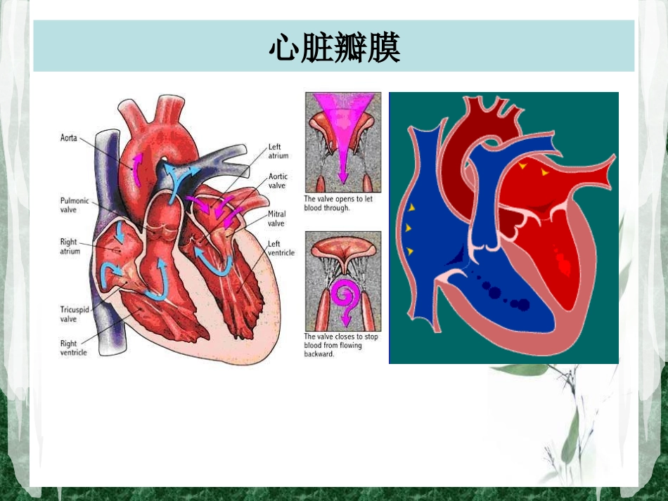 护理查房心脏瓣膜病_第2页