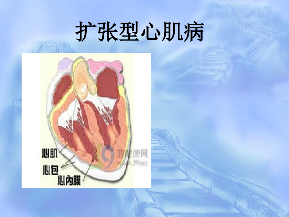 扩张型心肌病查房_第1页