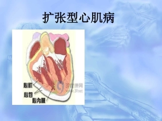 扩张型心肌病查房