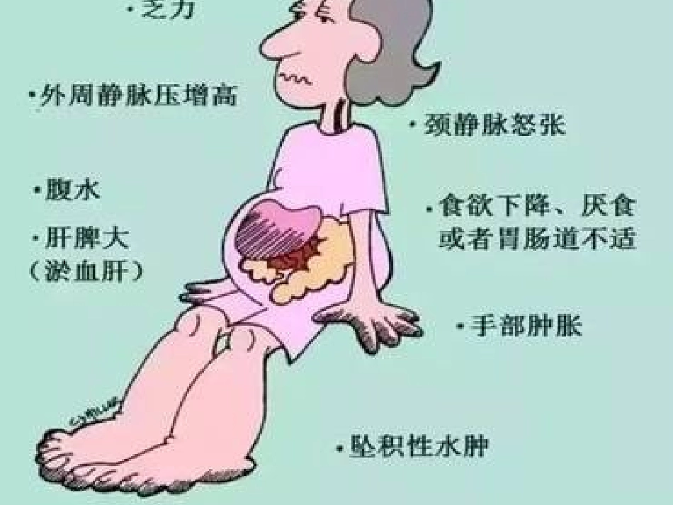 扩张性心肌病第二部分_第3页
