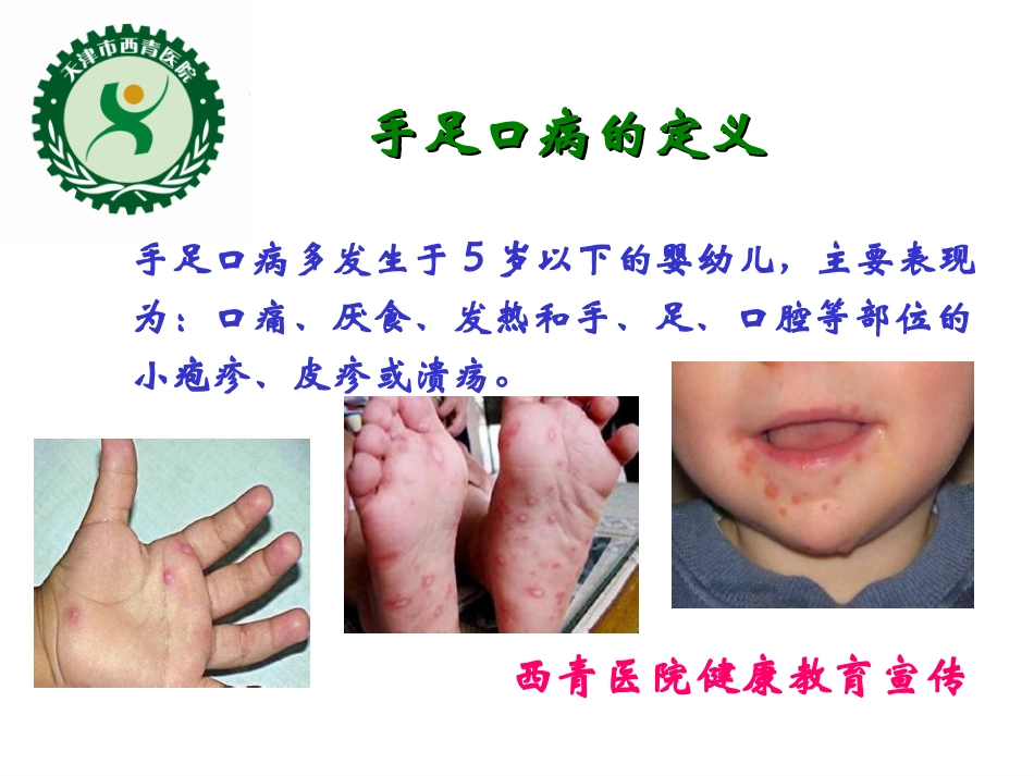 手足口病防治2014_第3页
