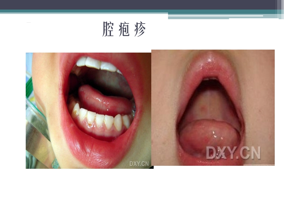 手足口病诊疗概要_第2页