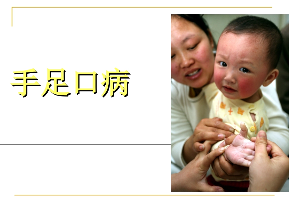 手足口病知识分析_第1页