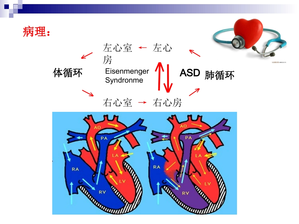 房缺与室缺的影像学鉴别_第3页