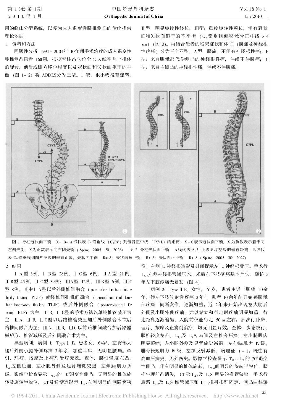 成人退变性腰椎侧凸的分型及手术方法选择_刘洪_第2页