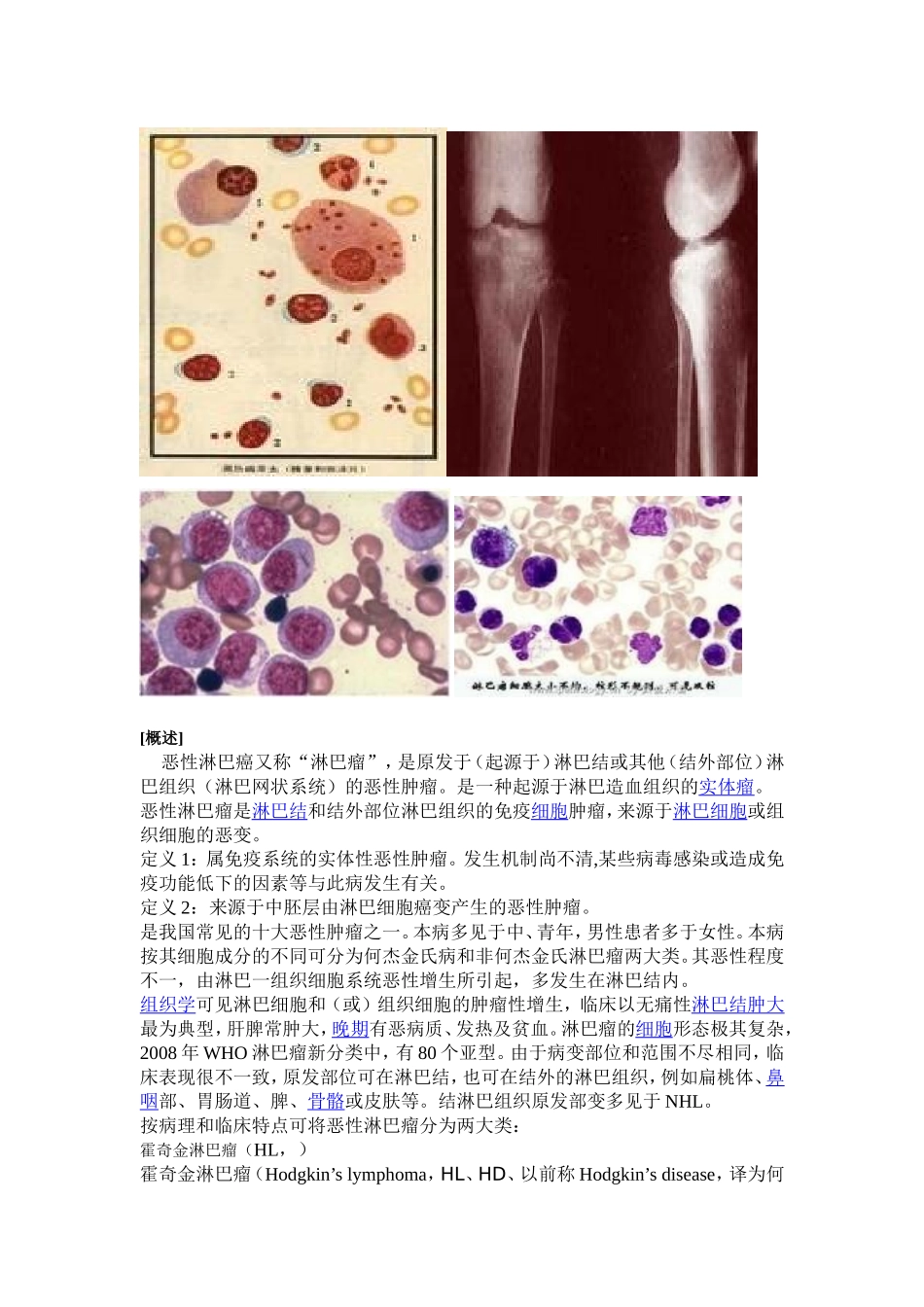 恶性淋巴瘤综述_第2页