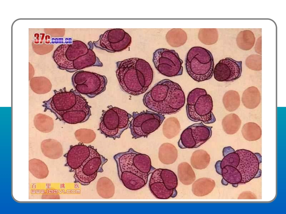 急性非淋巴细胞白血病PPT_第3页