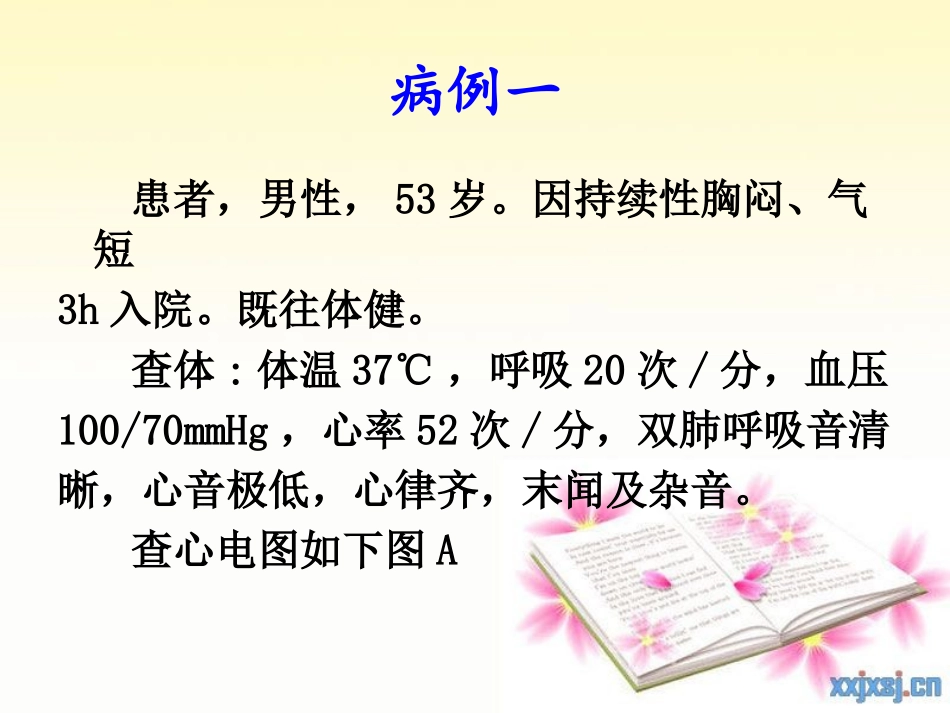 急性心梗早期心电图分析_第2页