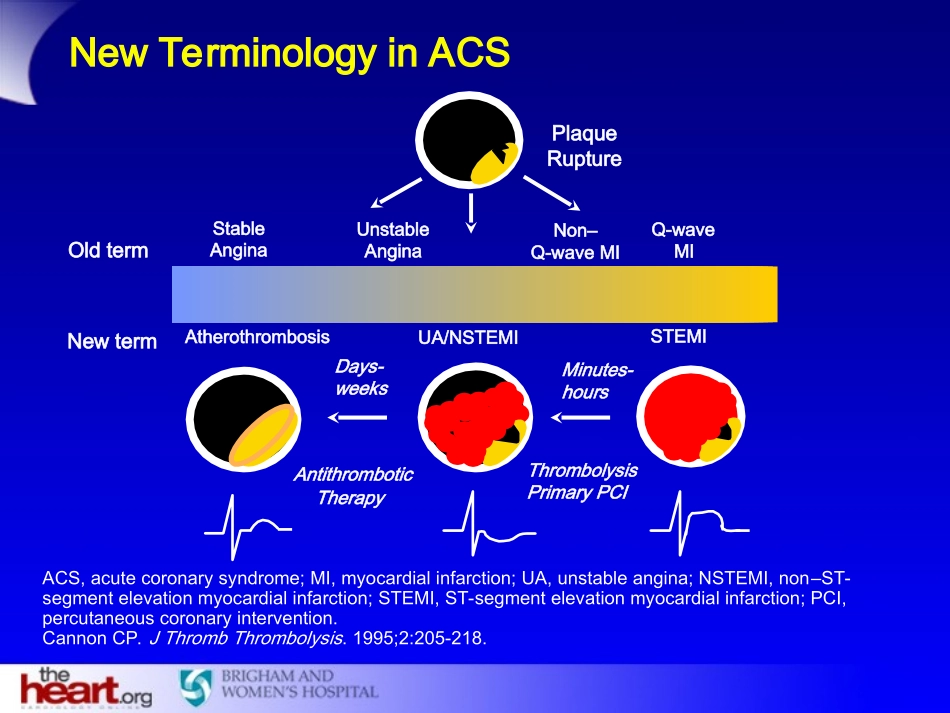 急性冠脉综合征评估及危险分层_第2页