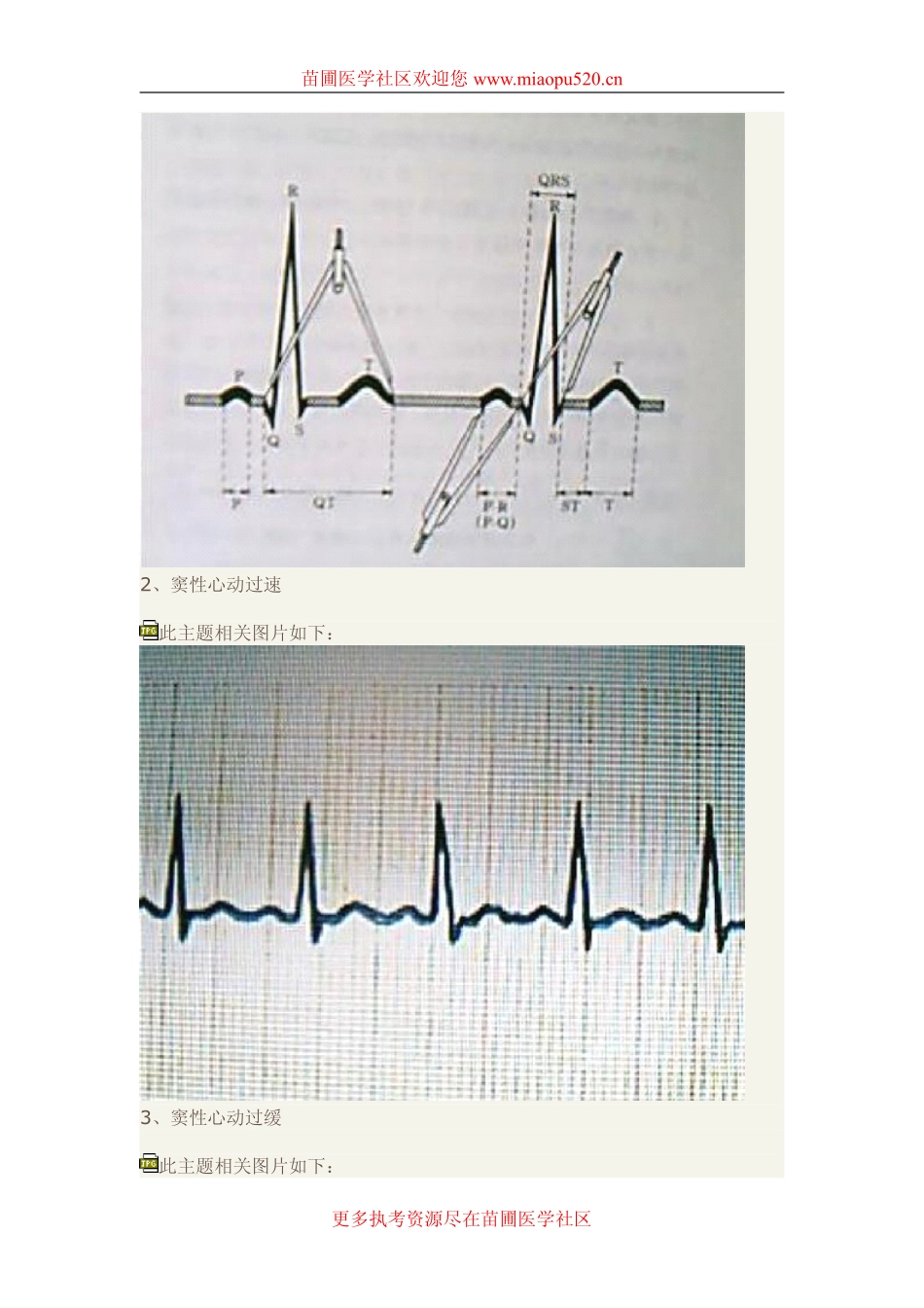 快速读懂心电图_第2页