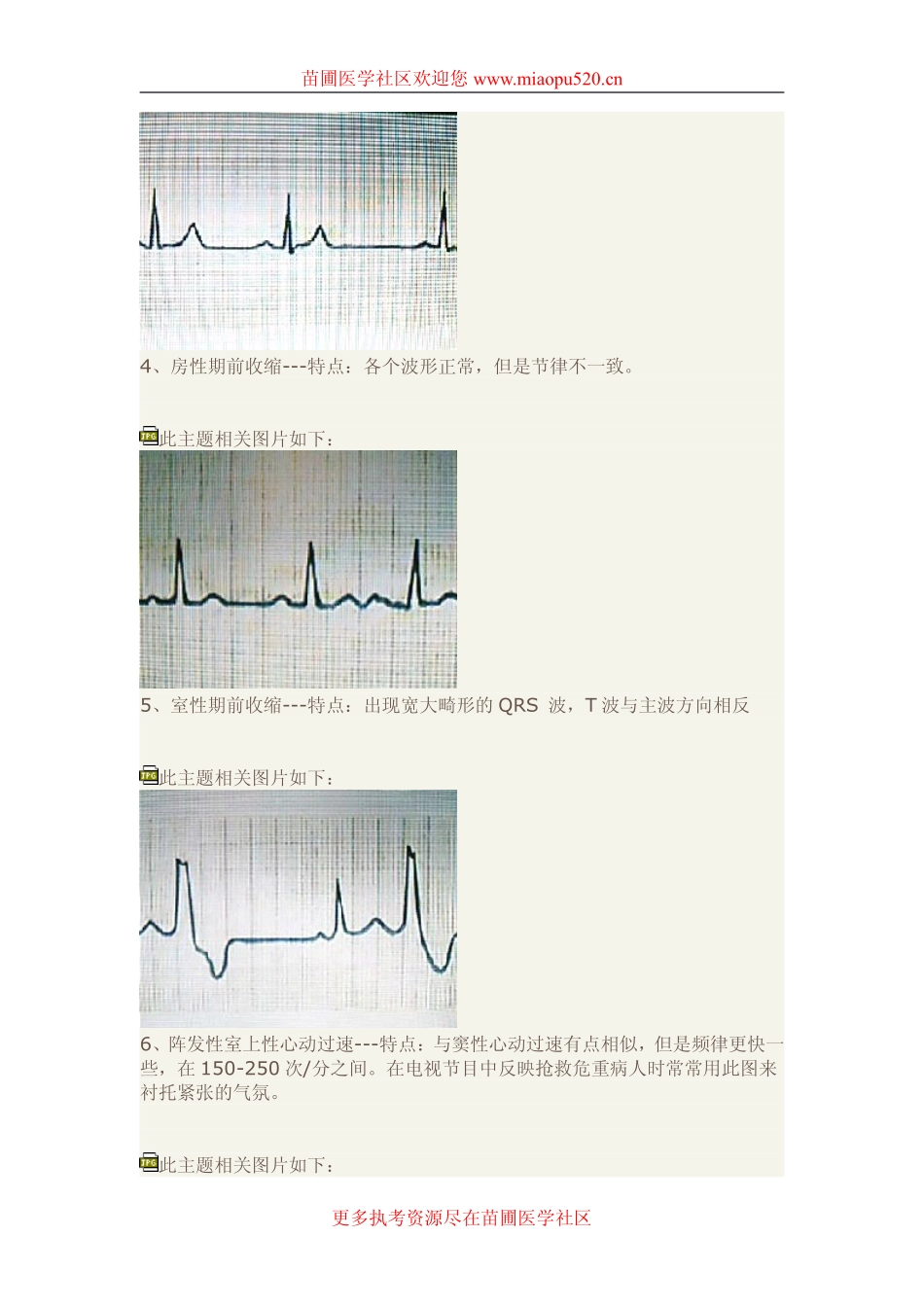 快速读懂心电图_第3页