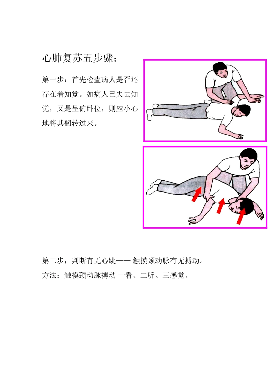 心肺复苏五步骤_第1页