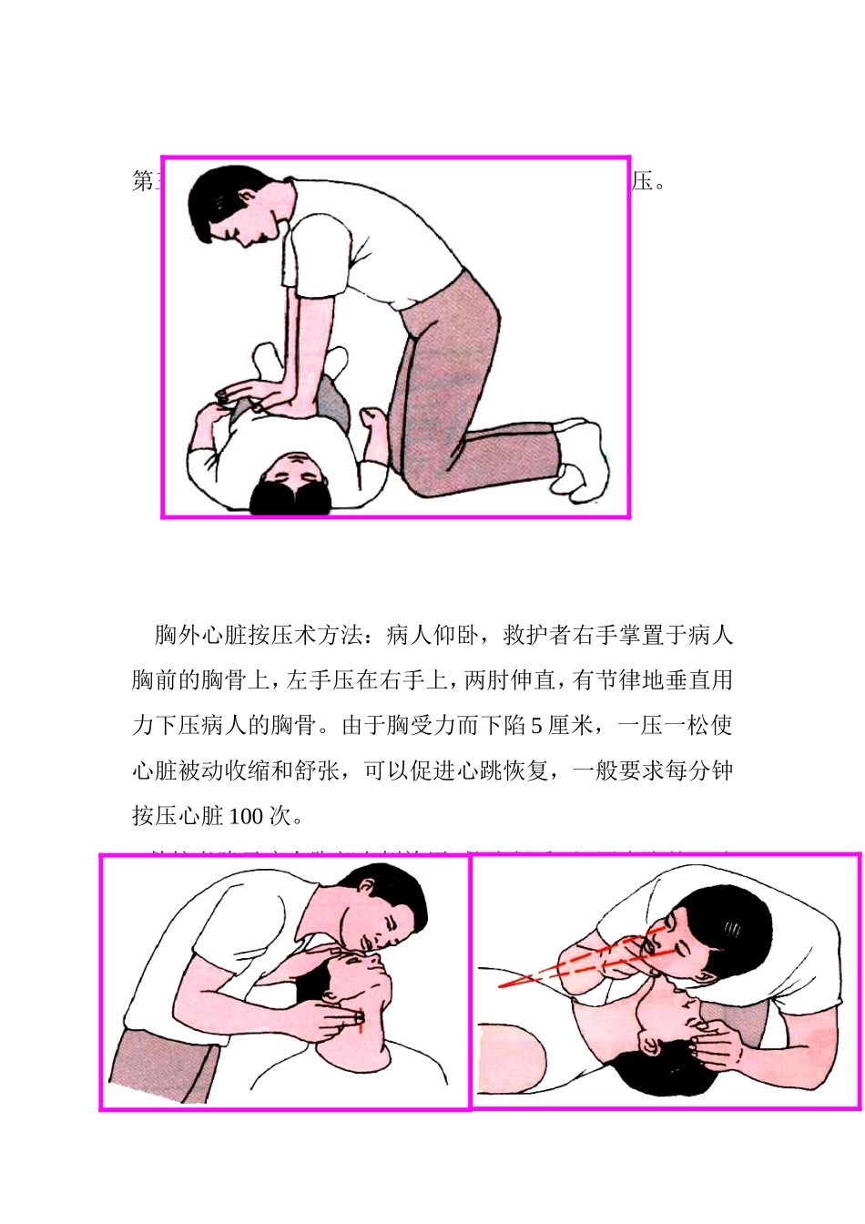 心肺复苏五步骤_第2页