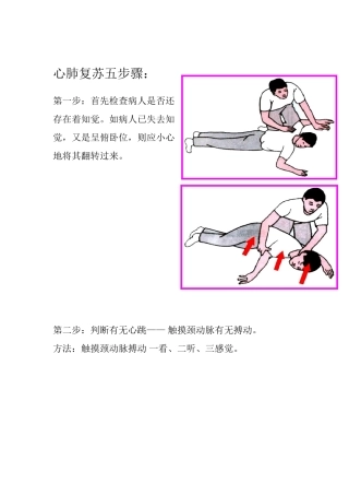 心肺复苏五步骤
