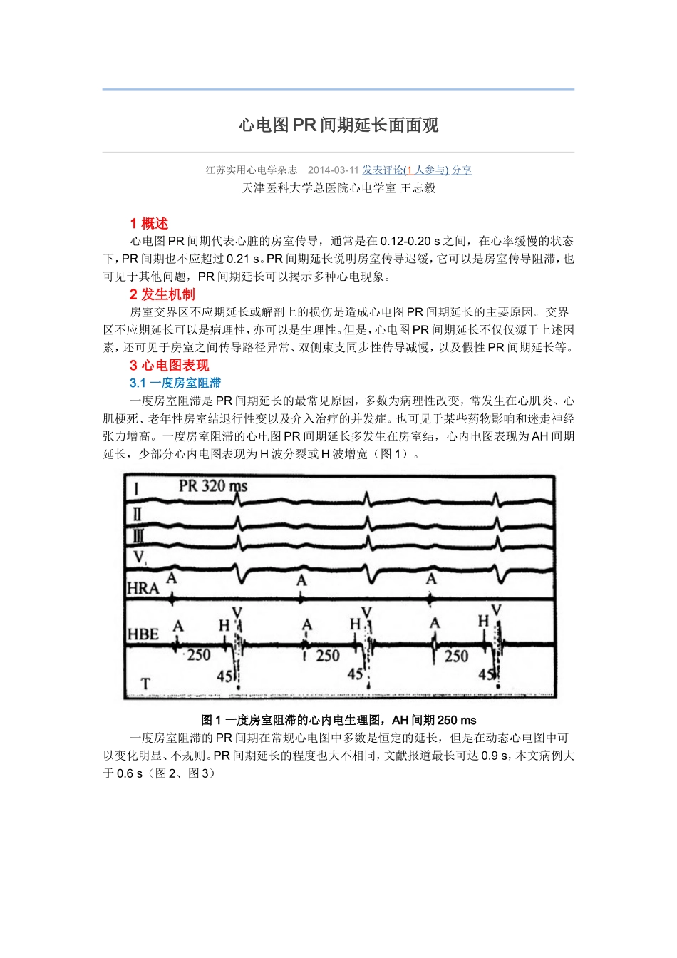心电图PR间期延长面面观_第1页