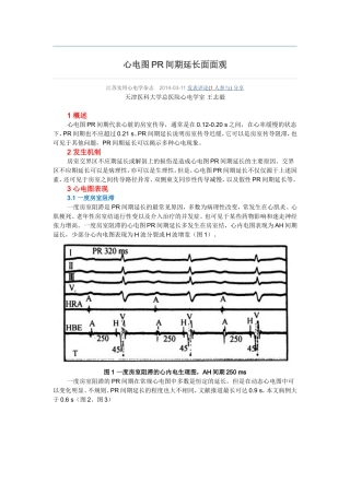 心电图PR间期延长面面观