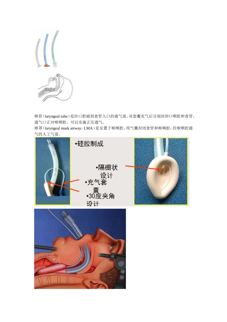 很粗略的介绍气管切开插管的相关问题_第3页