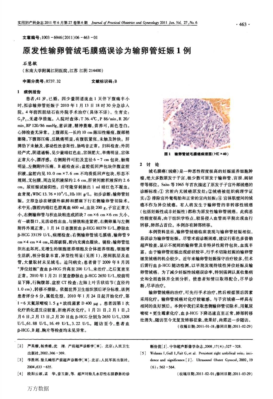 彩色多普勒超声诊断胎儿永久性右脐静脉及临床评估_第3页