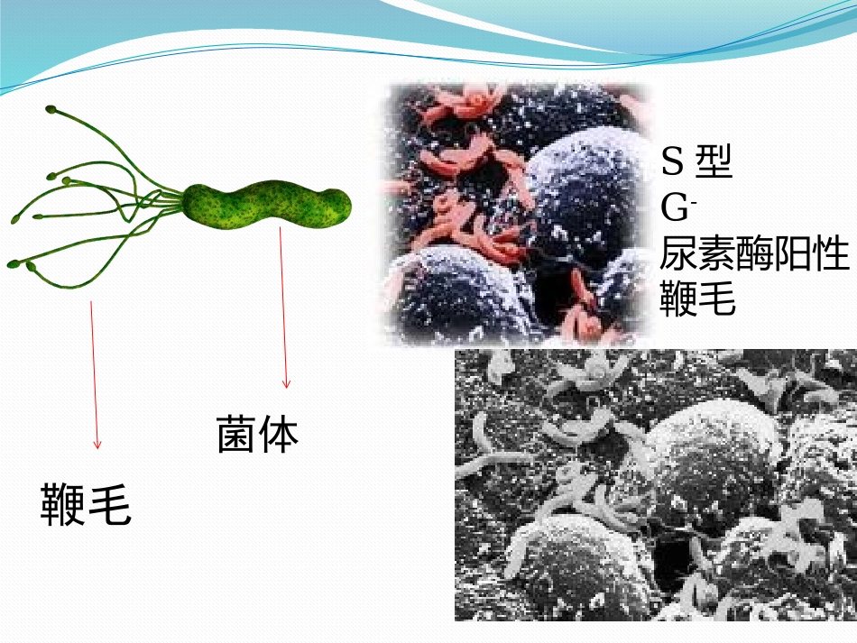 幽门螺杆菌感染_第2页