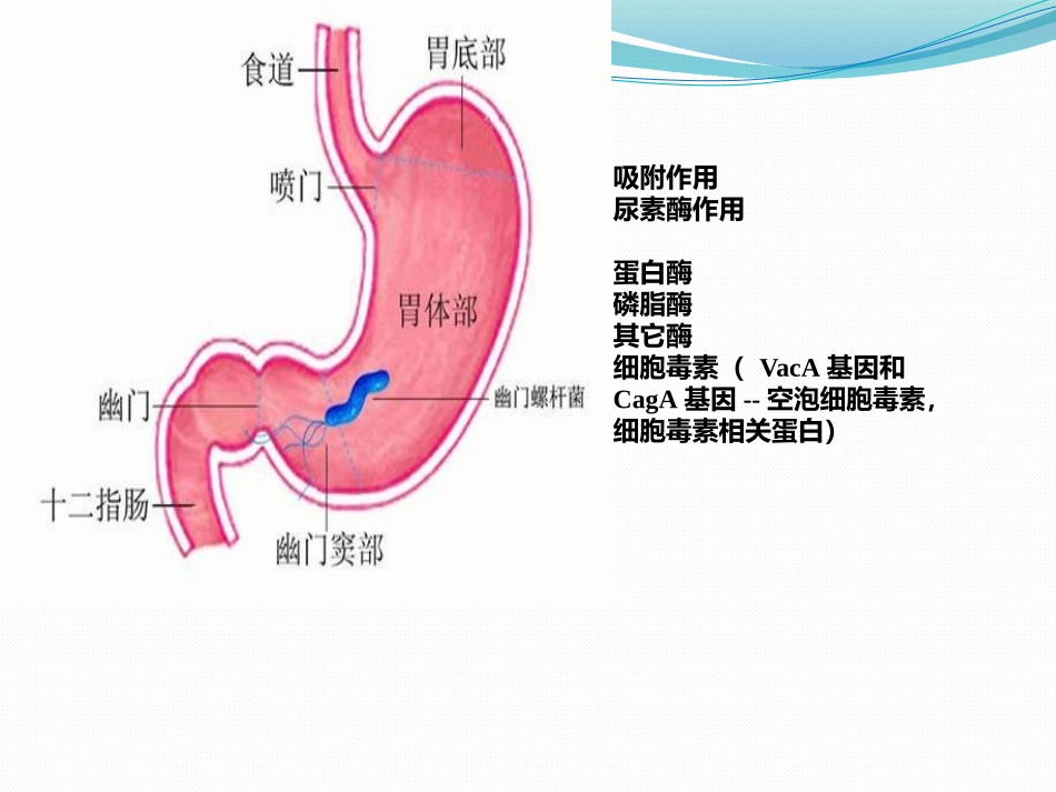 幽门螺杆菌感染_第3页