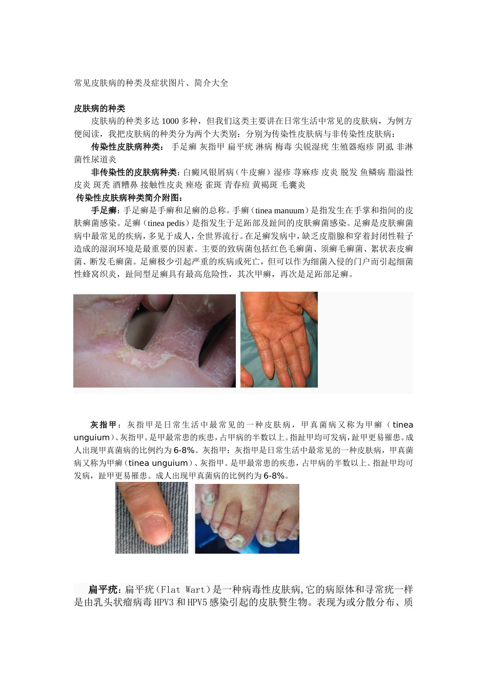 常见皮肤病的种类及症状图片、简介大全_第1页
