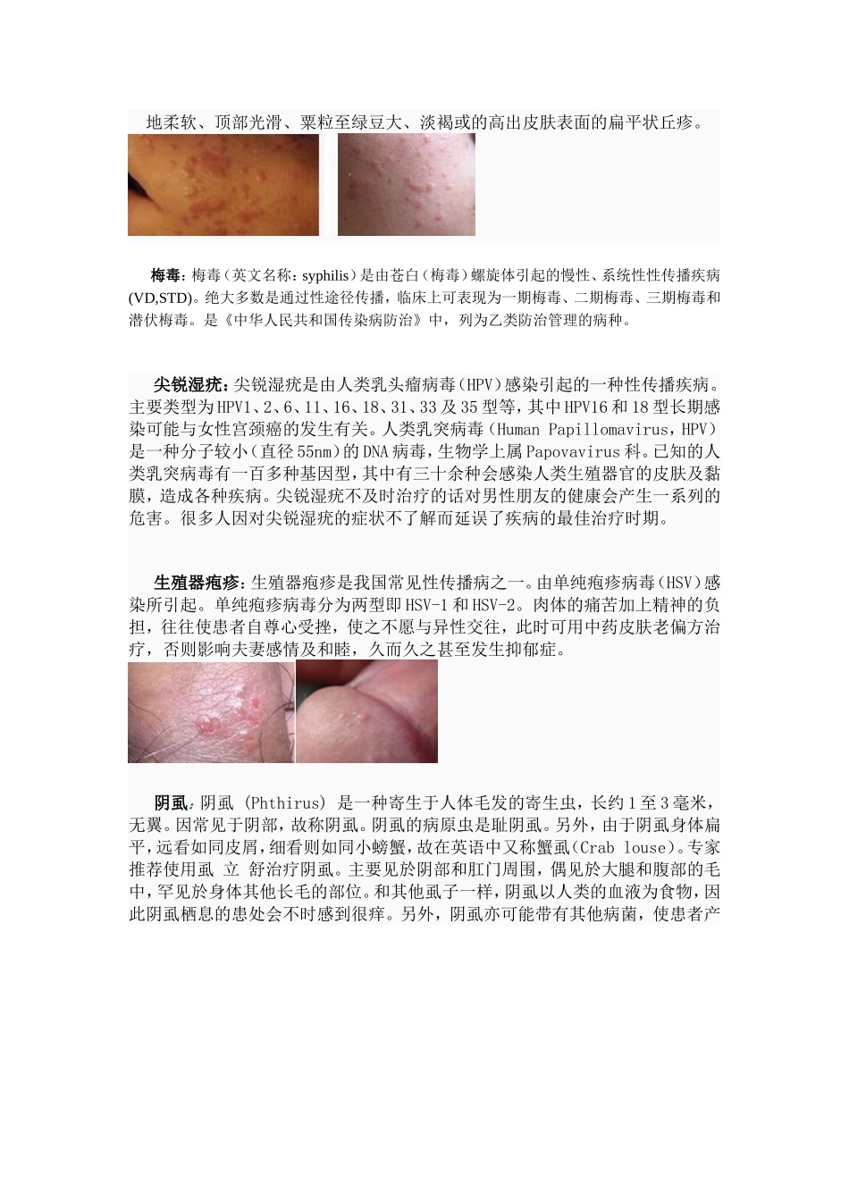 常见皮肤病的种类及症状图片、简介大全_第2页