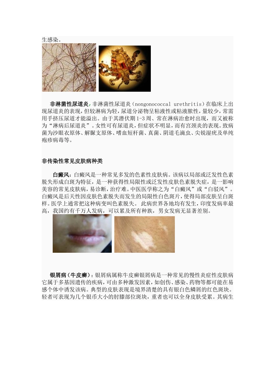 常见皮肤病的种类及症状图片、简介大全_第3页