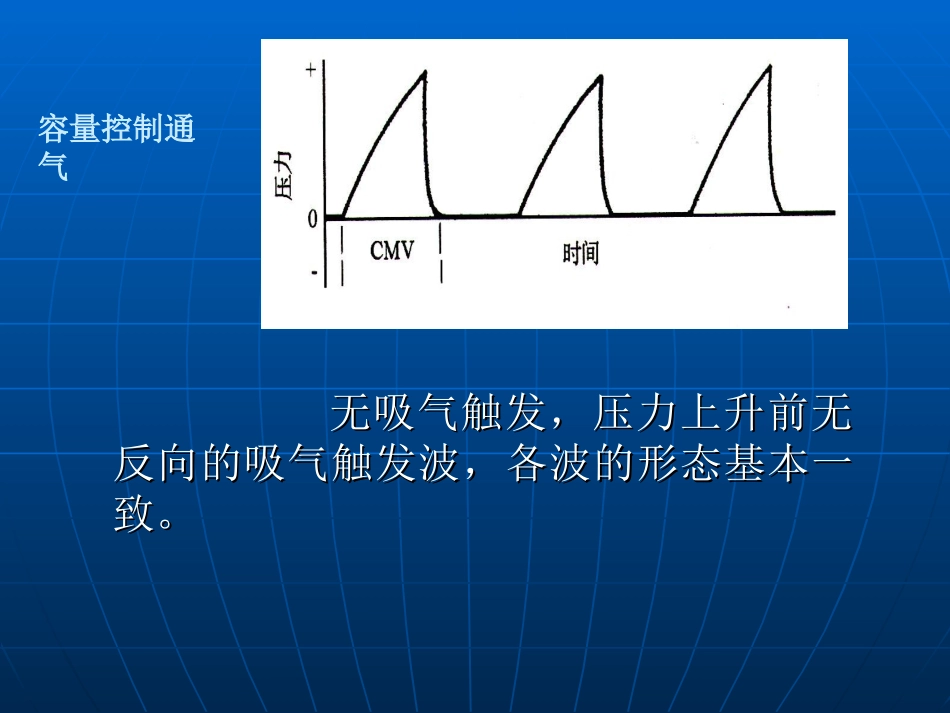 常见呼吸模式与参数设置_第3页