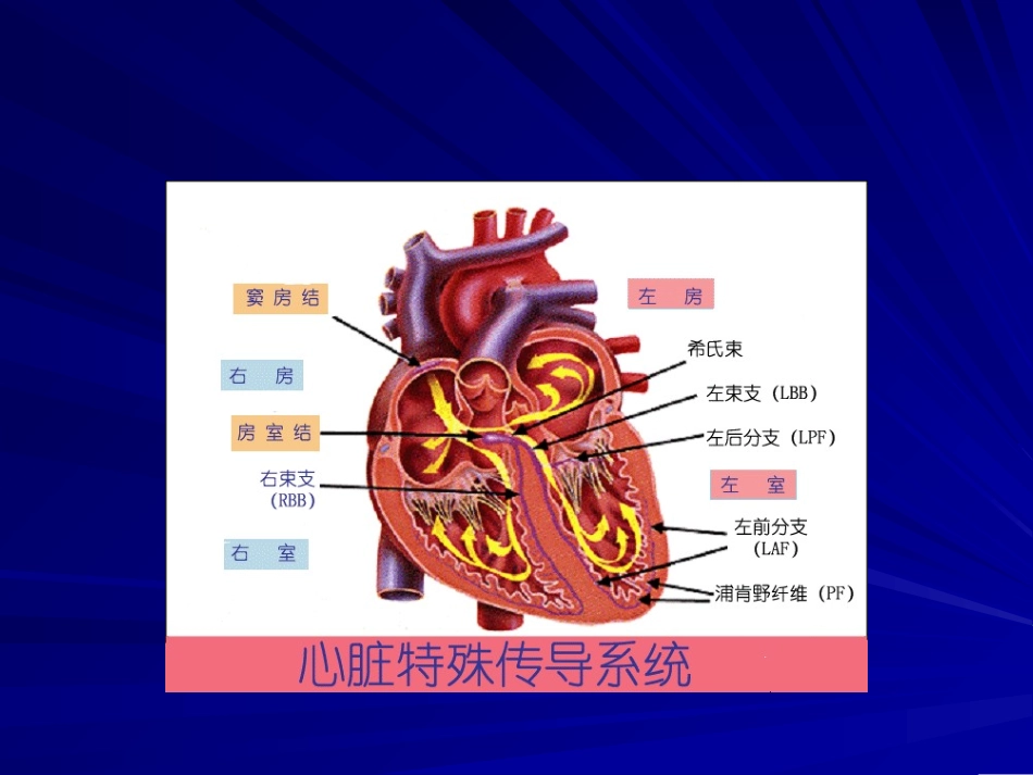 常见心电图的诊断1_第3页