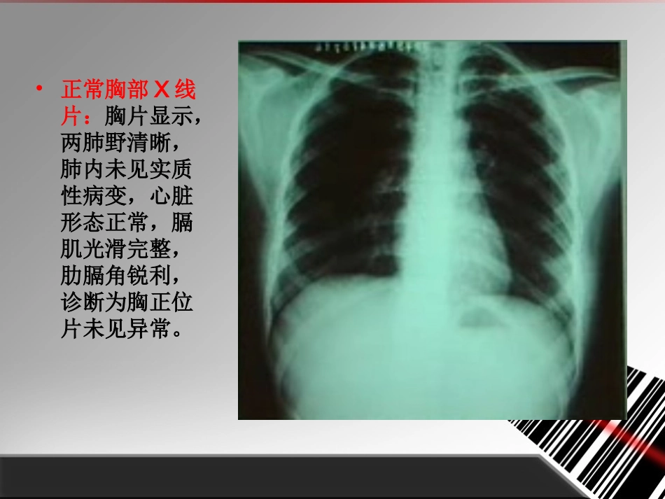 常见X线片诊断和描述_第2页
