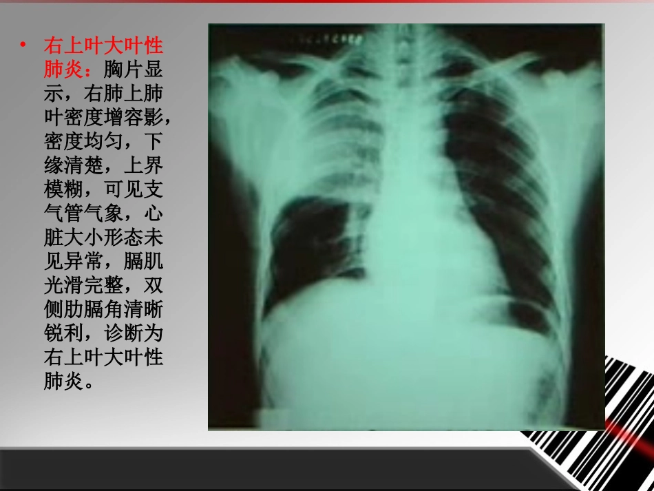常见X线片诊断和描述_第3页