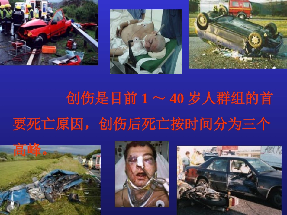 小容量复苏-失血性休克的一种新的液体疗法_第2页