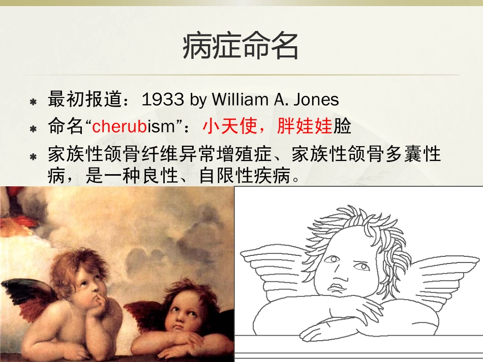 家族性巨颌症_第3页