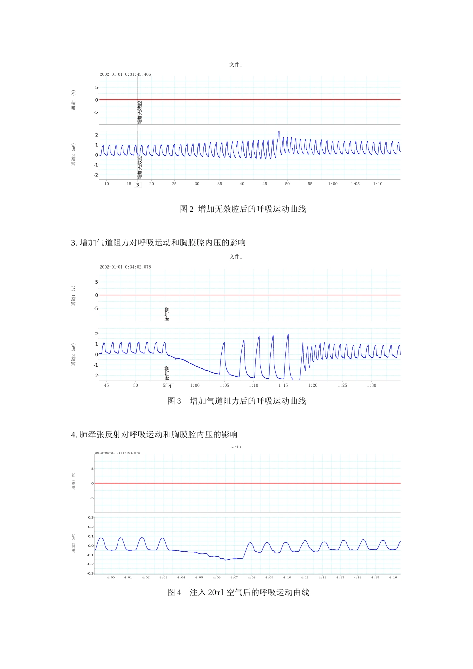 家兔呼吸运动和胸内负压的影响因素观测_第3页