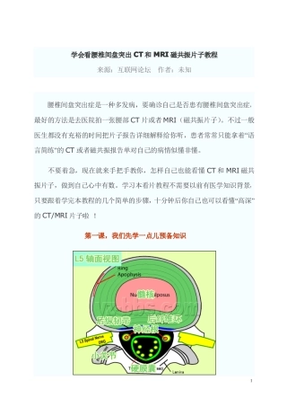 学会看腰椎间盘突出CT和MRI磁共振片子教程
