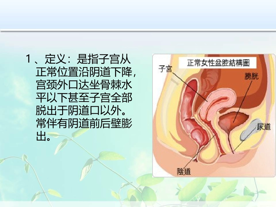 子宫脱垂.pptztt_第2页