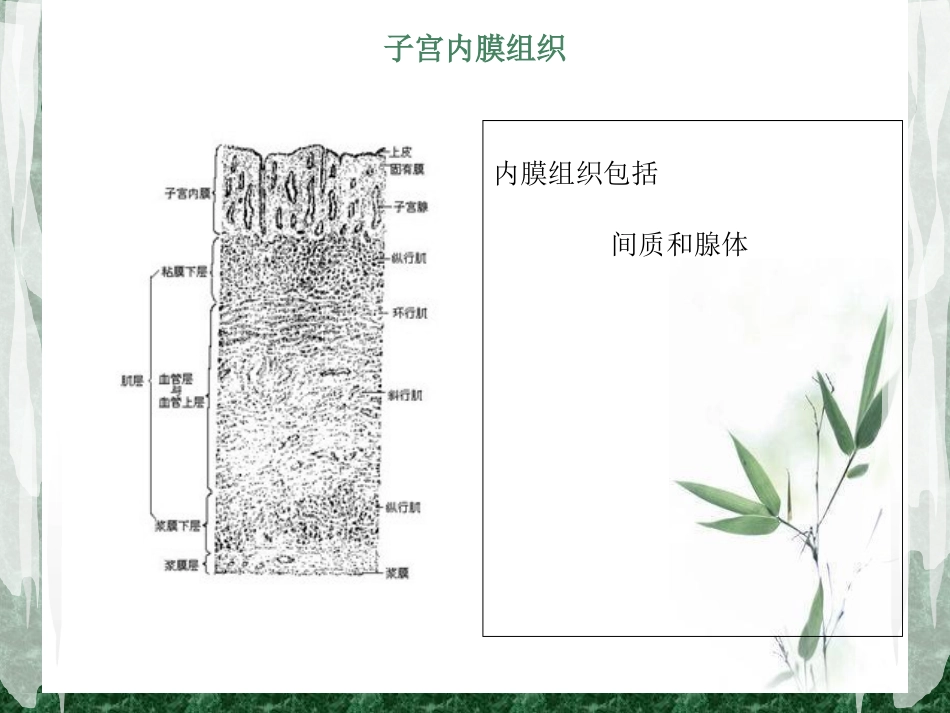 子宫内膜异位症_第3页