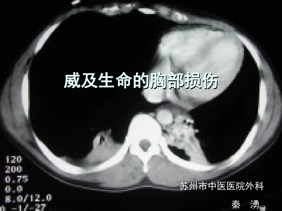 威及生命的胸部损_第1页