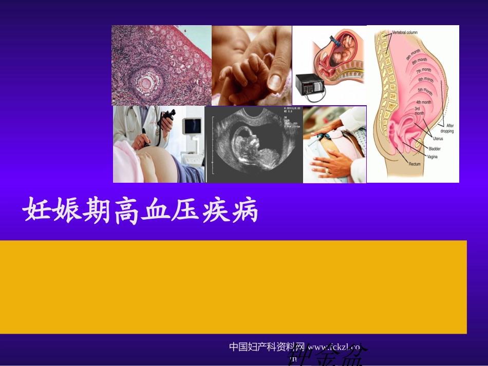 妊娠特有疾病：第二节 妊娠期高血压疾病_第1页