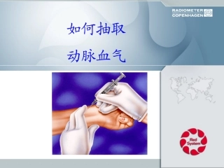 如何抽取动脉血.