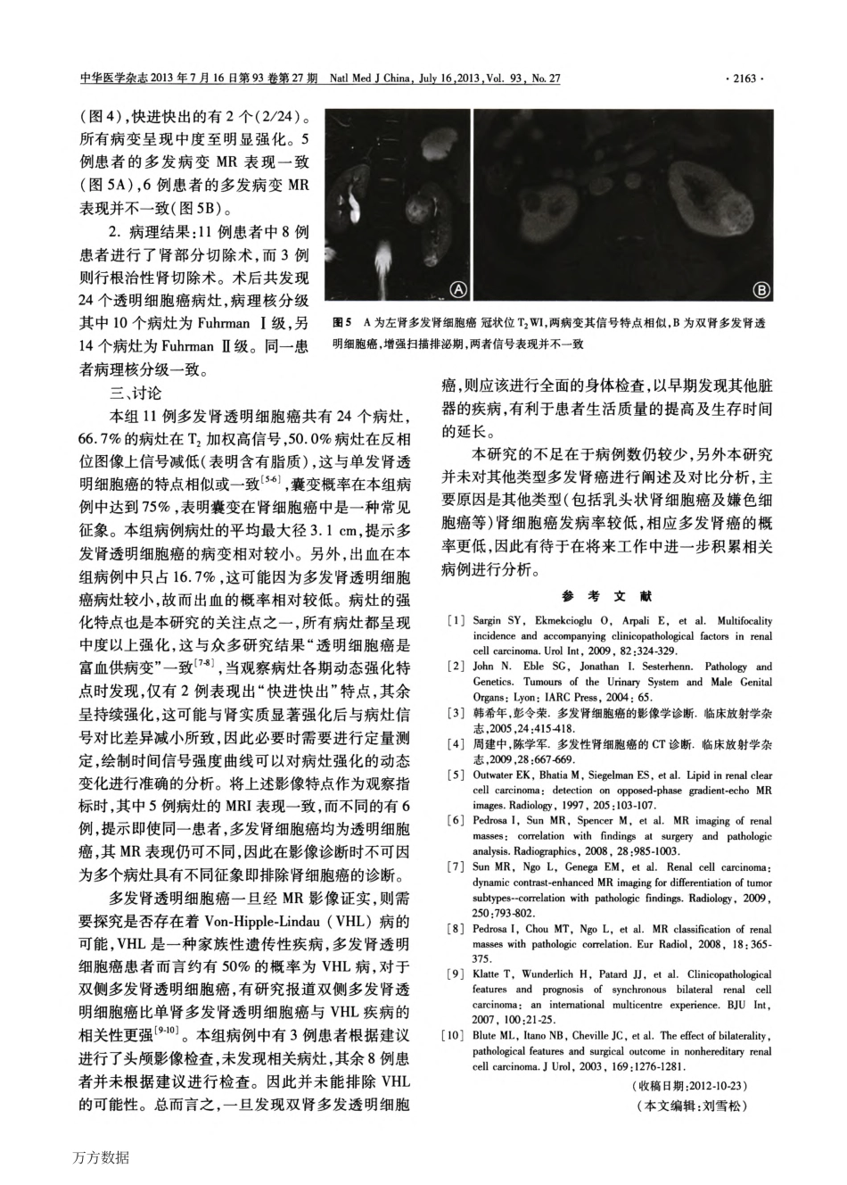 多发肾透明细胞癌11例磁共振影像分析_第3页