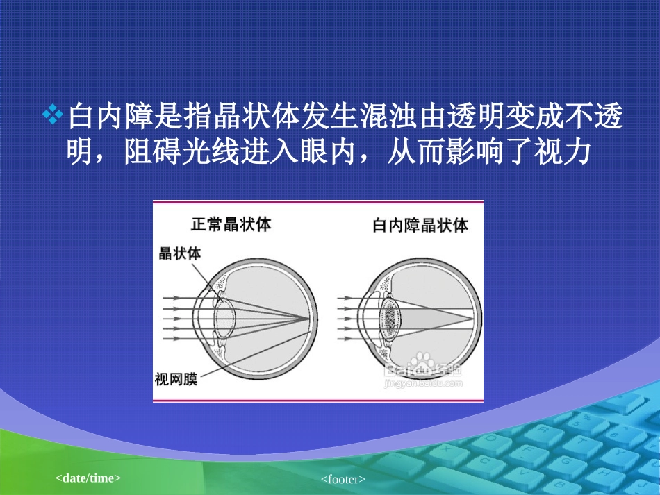 外伤性白内障_第3页
