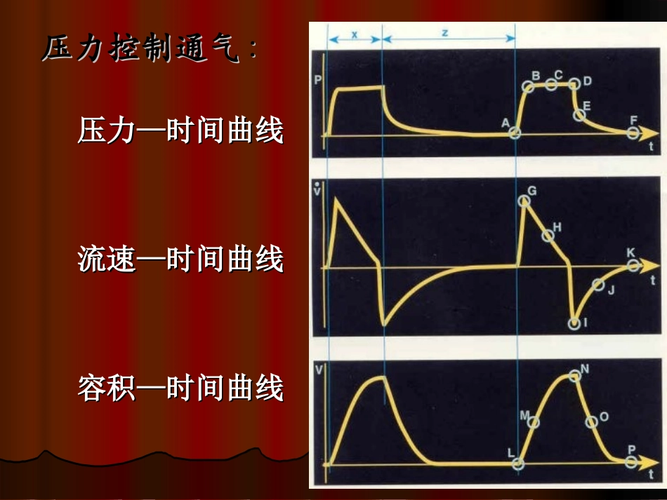 基础呼吸机波形分析_第3页